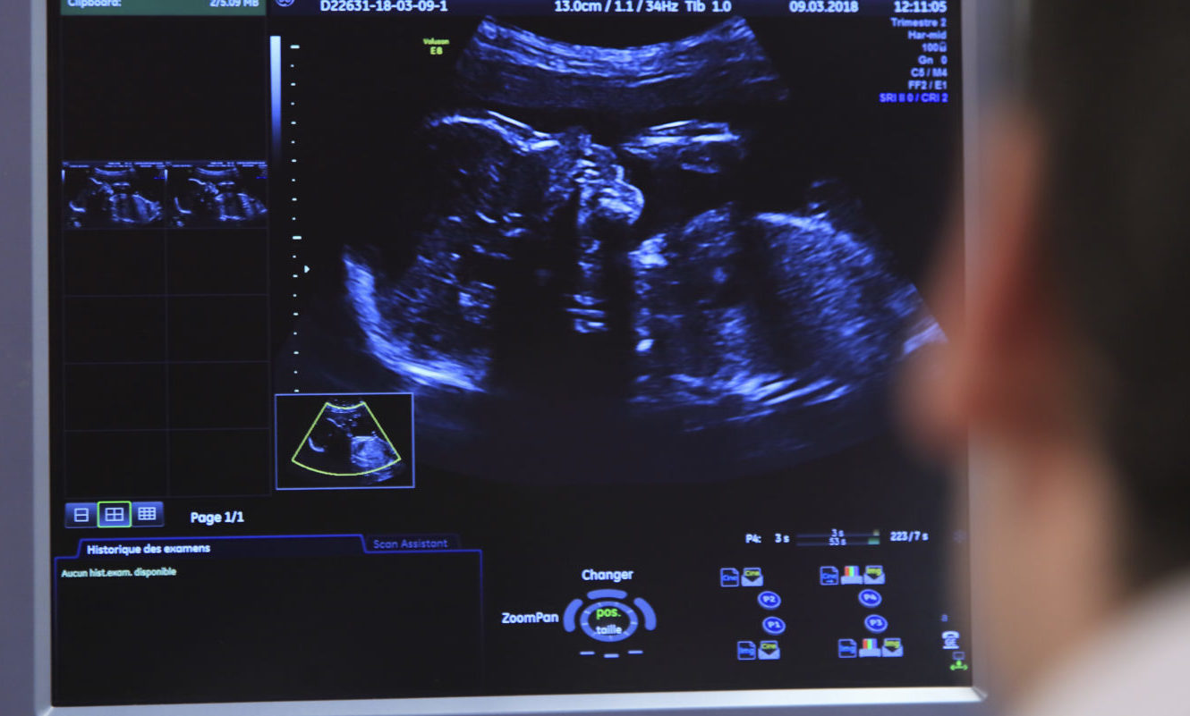 Olyan károkat okoz a környezetszennyezés, amire nem is gondoltunk