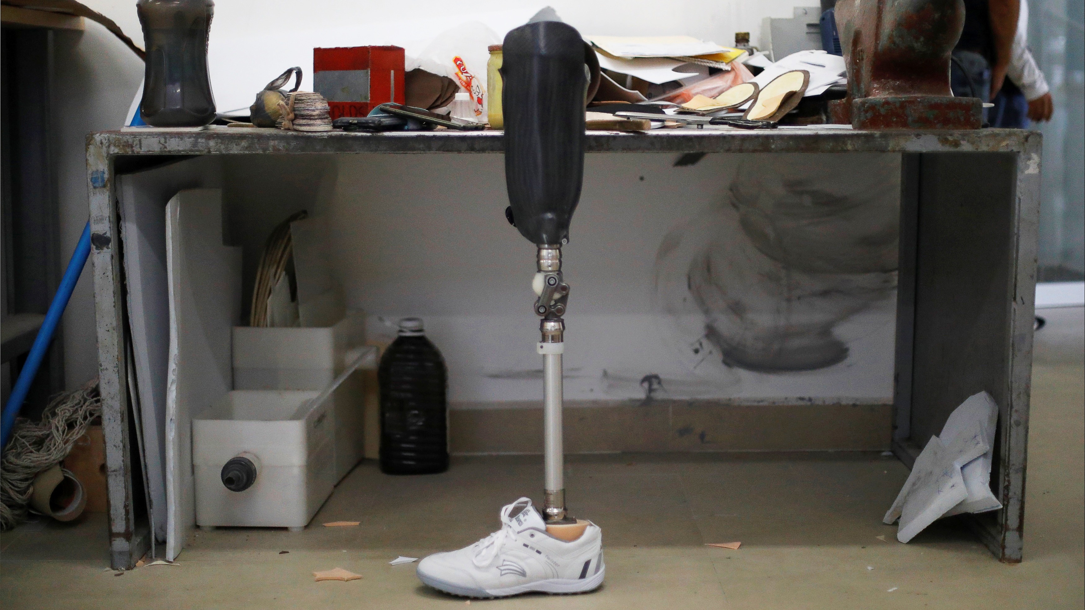 Prótesis para un migrante que perdió la pierna viajando en La Bestia.