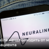 Чип Neuralink начал отходить от мозга первого пациента | Новости Украины