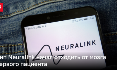 Чип Neuralink начал отходить от мозга первого пациента | Новости Украины
