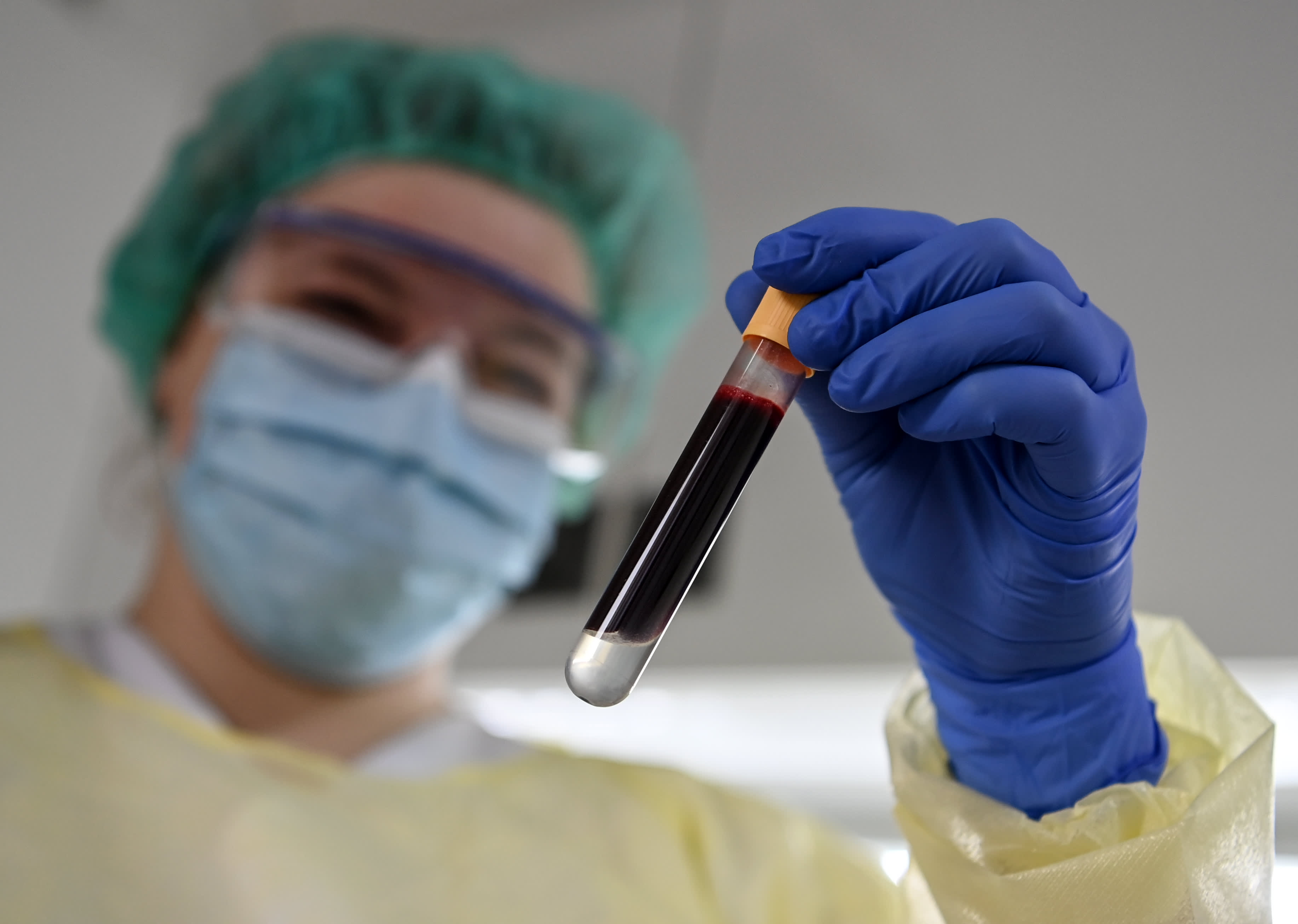 Theranos is history, but big blood testing breakthroughs are coming post-Covid